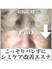 周りにバレずにシミケア！美白エステ14000円→12600円 くすみ/艶/老け顔改善