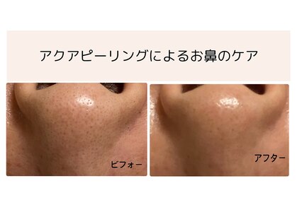 エムネージュ(M neige)の写真