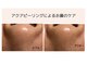 エムネージュ(M neige)の写真
