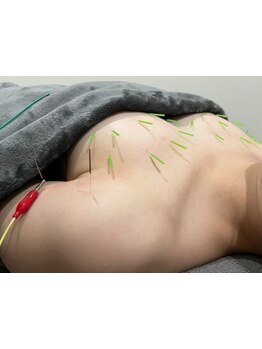 バストラインを整えたい