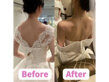 ボディキュア ブライダル美容整体 大阪梅田/どこから撮っても写真映え！