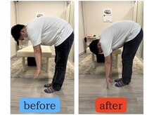 さざれ整体院 大垣店/腰痛のお客様！