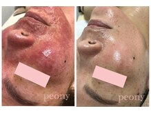 ピオニー(peony)/