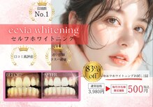 エクシアホワイトニング 大府店