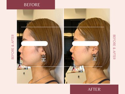 整え屋 レッド(RED)の写真