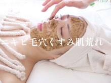 オーブ(Aube)の雰囲気（ダウンタイムなしハーブでツヤ感、透明感のある綺麗なお肌へ！）