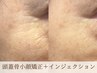 【40代からのシワ/たるみケア☆】頭蓋骨小顔矯正+インジェクション¥18,000→