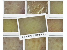 ピュリフィケーション(Purification)の雰囲気（毛穴の開き、つまり、黒ずみ。毛穴洗浄とキメを育てる。肌育ケア）