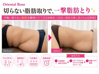 オリエンタルローザ 表参道(Oriental Rosa)/この効果は疑う！？まず感動体験