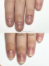 マリーロール 梅田店(Marie Laure)/自爪育成/深爪矯正/ネイルケア