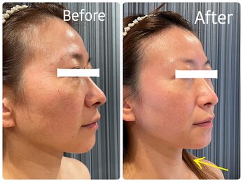 エクセレントビューティーサロン 艶(EN)/リベルハーブピーリンング