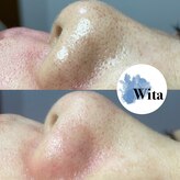 ウィタ(Wita)