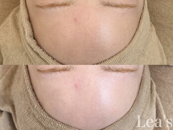 レアース(Lea's)/【潤艶Wax】フェイスワックス