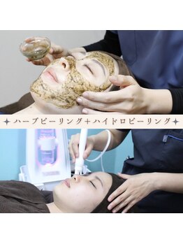 ハルミ 美容整体 新宿店(Harumi)の写真/《憧れのノーファンデが叶う》ハイドロピーリング+ハーブピーリングでザラつき,皮脂,毛穴汚れを徹底除去！