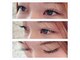 ルーフの写真