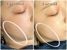 オプス ライフビューティー(OPS×LIFE BEAUTY)/超お得クーポン