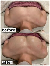 マイントゥー(mine too)/