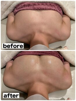 マイントゥー(mine too)/