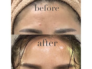 エヌ アンド エイチ ソニックフィット(N&H sonicfit)の写真/【埼玉でも希少なソニックフィット正規導入店！】肌印象を一新★全方向から見ても自信が持てる素肌へ◎