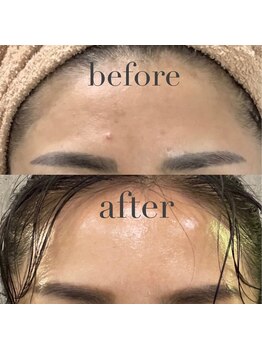 お肌をきれいにしたい