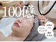 ルメア(LUMEA)の写真