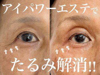 モンステラ(MONSTERA)の写真/【40代からの目元ケア】年齢を感じる目元のシワ、まぶたのたるみが気になる方へ。継続ケアで若々しい印象へ