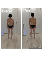 ラ ヴィ リッシュ(La vie riche)/脊椎が傾いてしまったお客様