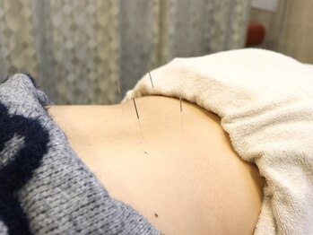 ザバス鍼灸整骨院 高槻富田院