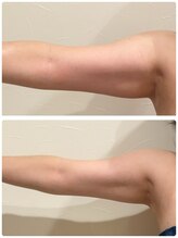 ディアウーマン(Dear Woman)/【スリミラボディ】二の腕