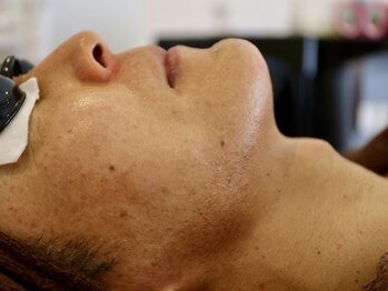 ラフラフ(Laf Laf)の写真/「清潔感は、ビジネススキル。」 ハイパワー脱毛で青ひげ・肌荒れを回避！清潔感×男前肌で商談に自信を！