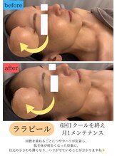 ユフラ(Juhla)/秋の乾燥による小ジワがふっくら