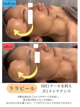 ユフラ(Juhla)/秋の乾燥による小ジワがふっくら