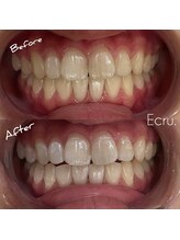 エクリュ(Ecru)/Before→After