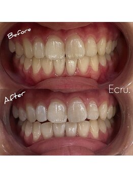 エクリュ(Ecru)/Before→After