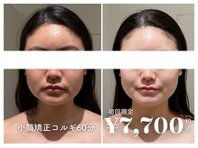 イデアルミー 大宮店(イデアルMe)の雰囲気（小顔ケア・毛穴ケア・ハーブピーリングが大人気!!）
