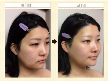 ディグニータココ 自由が丘(DIGNITA coco)/☆before after☆