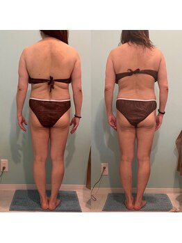 セカンドハウス(Second house)/ビフォーアフター(S様)