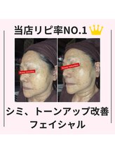 シン(Shin)/【シミ、トーンアップ改善】