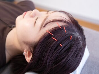 クーロ鍼灸院(curo鍼灸院)/ストレス・頭痛