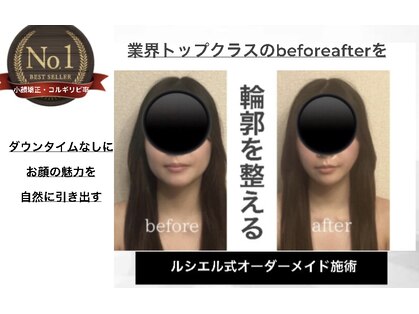ルシエルの写真