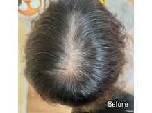 シャラ(shara)/プロセルセラピーズ