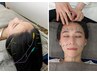 【1か月以内のご来院限定クーポン】美容鍼＋頭皮鍼セット16,500円→15,500円