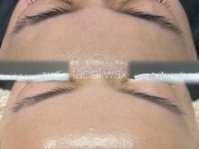 産毛・毛穴詰まり・くすみに/フェイシャルワックス/東大阪/布施