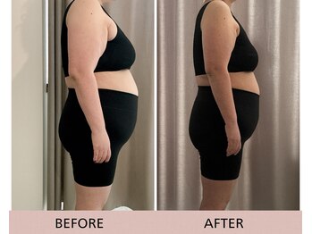 ヨサパーク ナズ(YOSA PARK nazu)/水素まみれコース♪20回コース