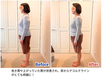 ラシュシュ/ビフォーアフター