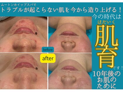 サロン テン(salon TEN)の写真