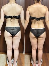 ヴィム(VIM)/ハイパーナイフ全身