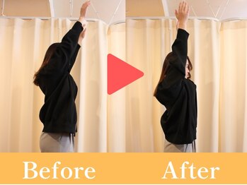 おひさま整骨院/ビフォー・アフター