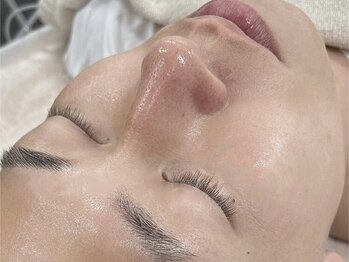 モイ(Moi’e)の写真/話題の韓国最新マシンで肌トラブルを改善したい方、季節のケアに★ふっくら艶玉肌を手に入れたいあなたへ♪