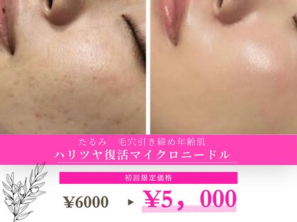 スムース イー(Smooth+E)の写真